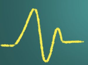 De krapte op de arbeidsmarkt is iets afgenomen. Vooral binnen de creatieve sector, in klantcontact en bij administratieve functies is minder vraag.